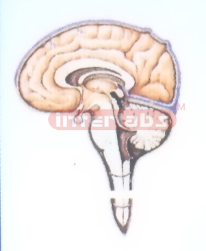 HANGING CEREBROSPINAL FLUID CIRCULATION MODEL